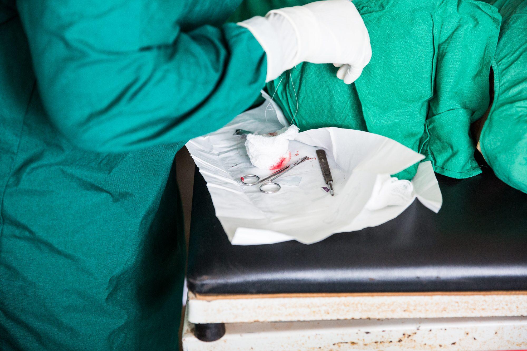 Trichiasis Surgery — photograph 8